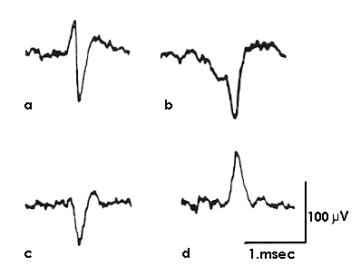 types of waveforms